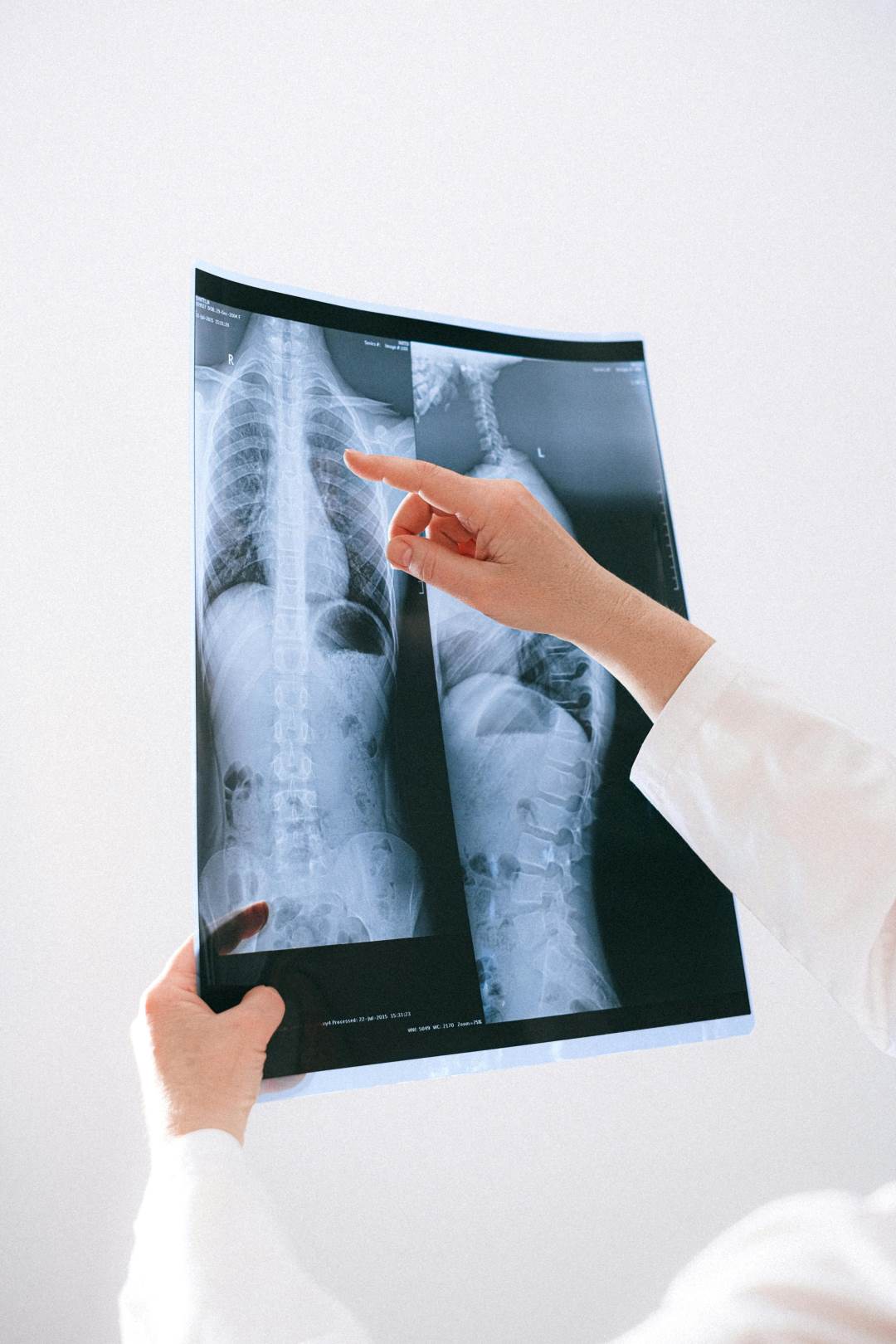 examining x-ray