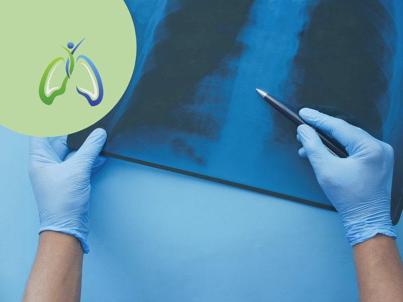 The Benefits of Private Care in Respiratory Medicine