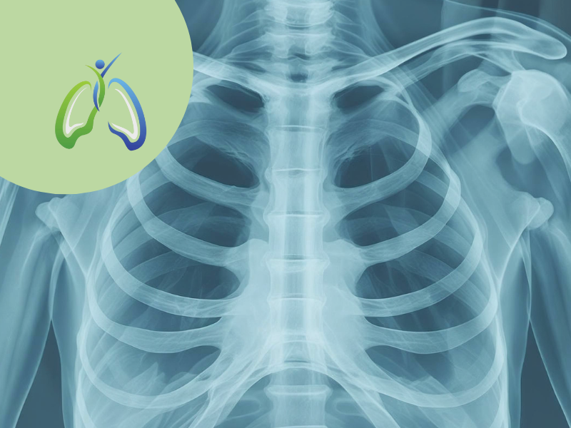 Looking After Your Lungs in 2026